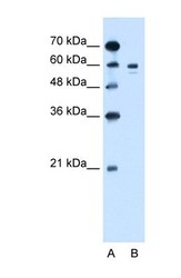 NBP1-69516 - Tyrosinase (TYR)
