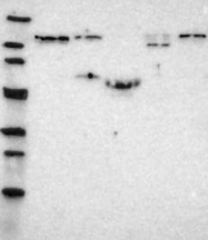 NBP1-87825 - TYK2