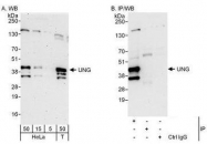 NBP1-49985 - Uracil-DNA glycosylase (UNG)