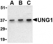 NBP1-77259 - Uracil-DNA glycosylase (UNG)