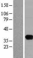 NBL1-17620 - uracil-DNA glycosylase Lysate