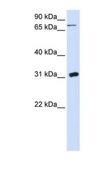 NBP1-55354 - Uridine phosphorylase 1 (UPP1)