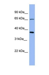NBP1-58867 - Uromodulin (UMOD)