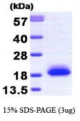 NBP1-30228 - Visinin-like protein 1 / HLP3