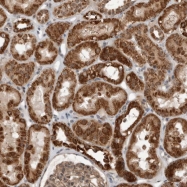 NBP1-86722 - WDYHV1