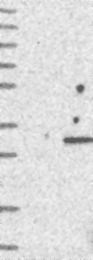 NBP1-86722 - WDYHV1