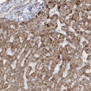 NBP1-92613 - ZNF180