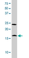 PAB0003 - Histone H2A.x