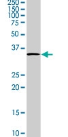 PAB0005 - Adiponectin