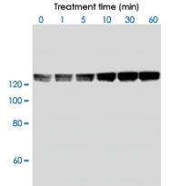 PAB0009 - PPP1R12A / MYPT1