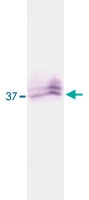PAB0138 - KLK5 / Kallikrein-5