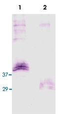 PAB0139 - KLK5 / Kallikrein-5