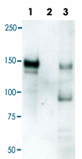 PAB0140 - LRIG1
