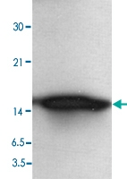 PAB0141 - PEN2