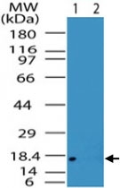 PAB0152 - ACP1 / LMW-PTPase