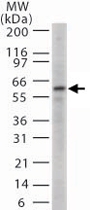 PAB0155 - CD262 / TRAILR2