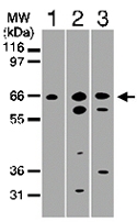 PAB0156 - TNFRSF21 / Death receptor 6 (DR6)