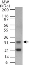 PAB0157 - MYD88