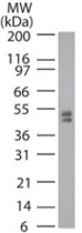PAB0161 - DNMT2 / TRDMT1