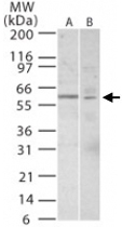 PAB0162 - TERF1