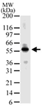 PAB0164 - MBD4