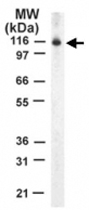 PAB0168 - STAT2