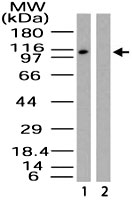 PAB0170 - MeCP2