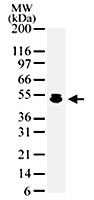 PAB0171 - HDAC3