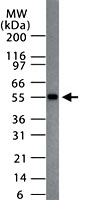 PAB0172 - MBD1
