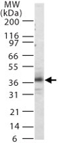PAB0178 - CD181 / IL8RA
