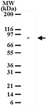 PAB0179 - MRE11
