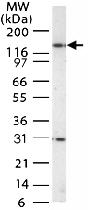 PAB0181 - HDAC4