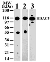 PAB0182 - HDAC5