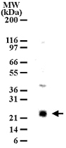 PAB0184 - LY86 / MD-1