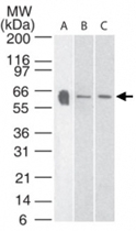 PAB0187 - Serotonin receptor 3A (HTR3A)