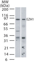 PAB0192 - EZH1