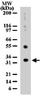 PAB0194 - Uracil-DNA glycosylase (UNG)