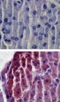 PAB0195 - CD282 / TLR2