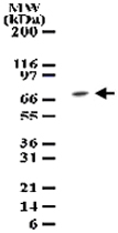 PAB0196 - TAK1 / MAP3K7