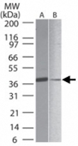 PAB0197 - SIRT7