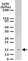 PAB0198 - CARD5 / PYCARD / ASC