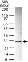 PAB0202 - ANP32B
