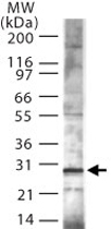 PAB0205 - TP53INP1