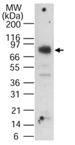 PAB0206 - CpG-binding protein
