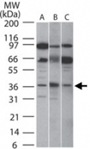 PAB0207 - SIRT5
