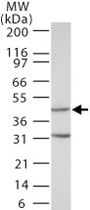PAB0212 - MAPK3 / ERK1