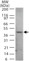 PAB0213 - CAMK1D