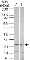 PAB0214 - SOCS1