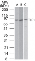 PAB0215 - CD281 / TLR1