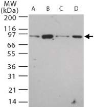 PAB0220 - TLR12